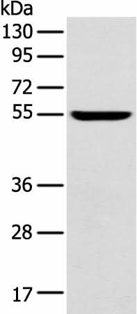 Western blot analysis of Mouse brain tissue using FOXG1 Polyclonal Antibody at dilution of 1:550