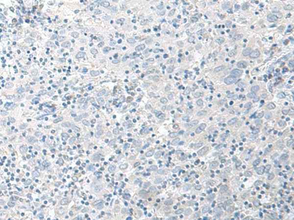 Anti-Human/Mouse/Rat STAU2 Antibody