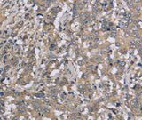 Anti-Human DTNB Antibody - ABMIUM