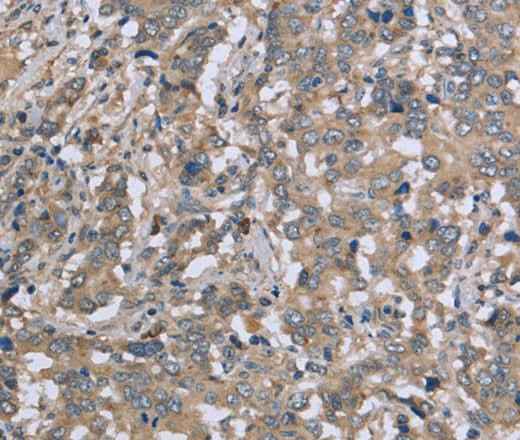 Anti-Human DTNB Antibody