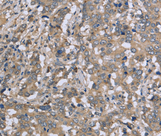 Anti-Human DTNB Antibody - ABMIUM