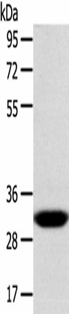 Anti-Human/Mouse/Rat CCS Antibody - ABMIUM