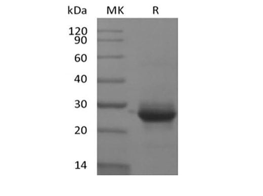 Recombinant Human KRAS(G12V, N-6His) - ABMIUM