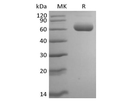 Recombinant Mouse Siglec-F (C-6His) - ABMIUM