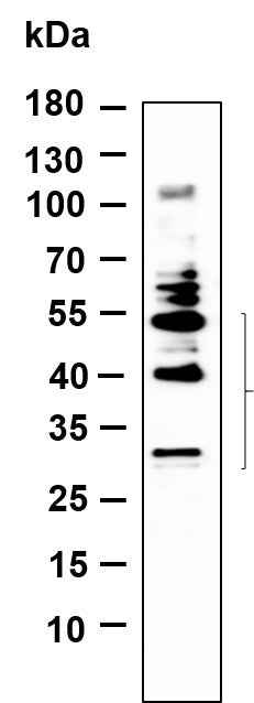 Anti-Human/Mouse/Rat BNIP-3 Antibody [B881] - ABMIUM