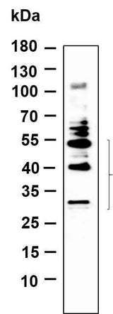 Anti-Human/Mouse/Rat BNIP-3 Antibody [B881]