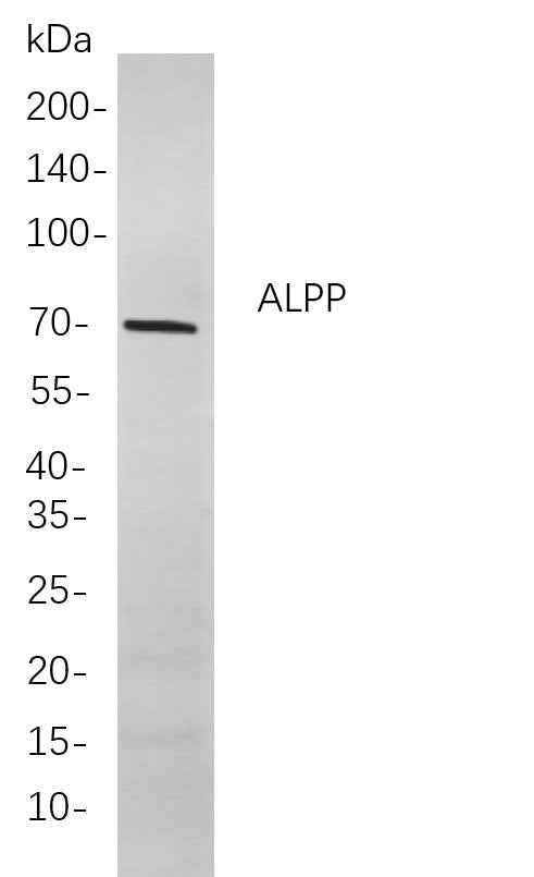 Anti-Human/Mouse/Rat ALPP Antibody [B806] - ABMIUM