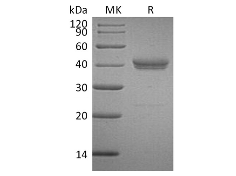 Recombinant Human CADM3 Protein (His Tag) - ABMIUM