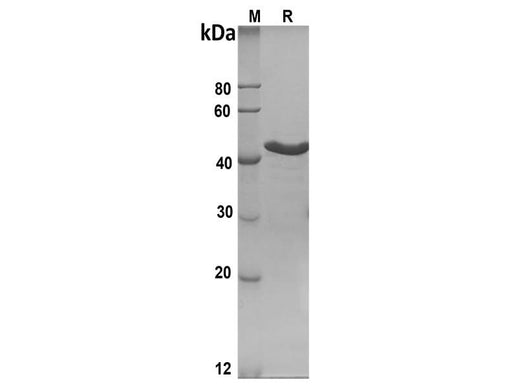 SDS-PAGE analysis of Human NMP22 proteins, 2 μg/lane of Recombinant Human NMP22 proteins was resolved with SDS-PAGE under reducing conditions, showing bands at 46 kDa.