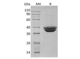 Recombinant Human GPA33 Protein (His Tag) - ABMIUM