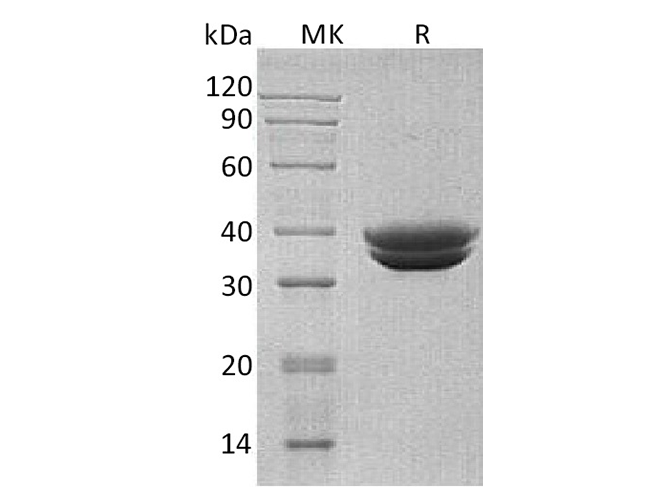 Recombinant Human GPA33 Protein (His Tag) - ABMIUM