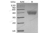 Recombinant Human HEPACAM Protein (His Tag) - ABMIUM