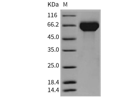 > 98 % as determined by reducing SDS-PAGE.