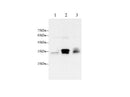 Anti-Human/Mouse Pentraxin 3 Antibody - ABMIUM