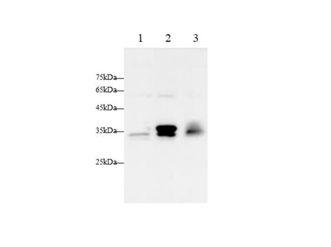 Anti-Human/Mouse Pentraxin 3 Antibody - ABMIUM