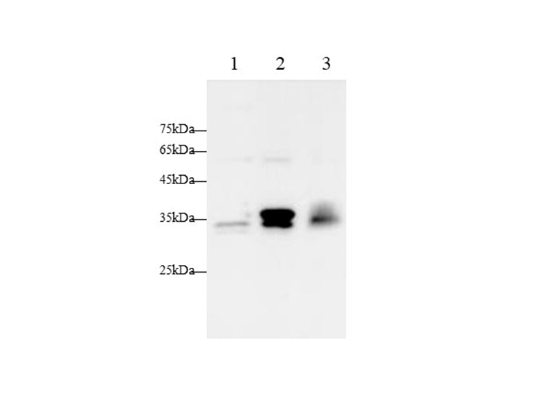 Anti-Human/Mouse Pentraxin 3 Antibody - ABMIUM