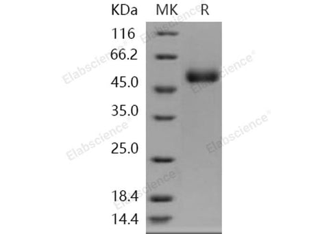 Recombinant Human ACPL2 Protein (His Tag) - ABMIUM