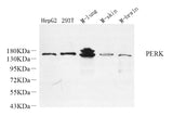 Western Blot analysis of various samples using PERK Polyclonal Antibody at dilution of 1:800.