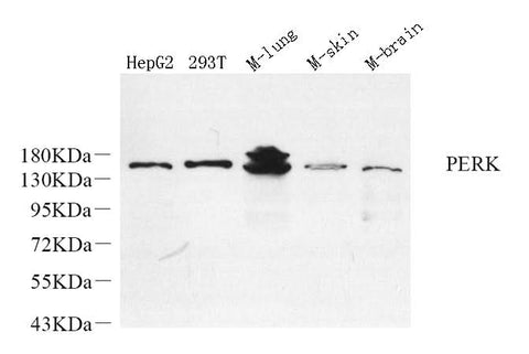 Western Blot analysis of various samples using PERK Polyclonal Antibody at dilution of 1:800.