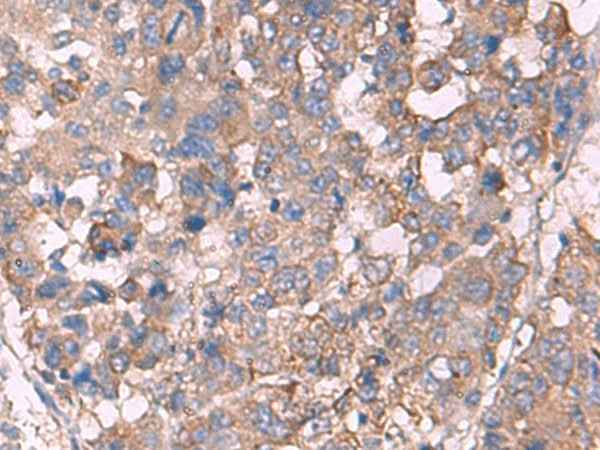 Anti-Human/Mouse/Rat KCNN3 Antibody