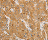 Anti-Human/Mouse/Rat NGF Antibody - ABMIUM