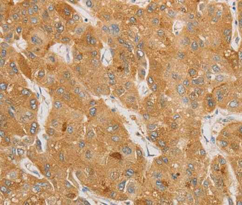 Anti-Human/Mouse/Rat NGF Antibody
