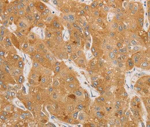 Anti-Human/Mouse/Rat NGF Antibody