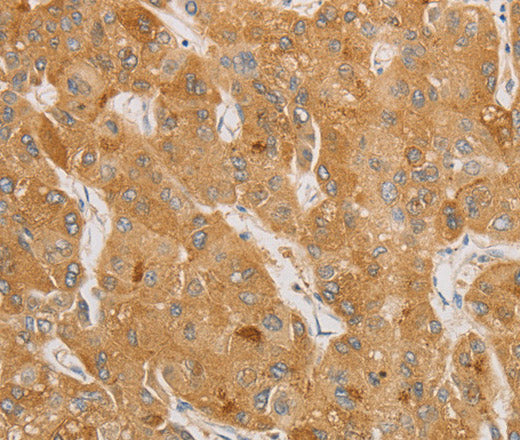 Anti-Human/Mouse/Rat NGF Antibody - ABMIUM