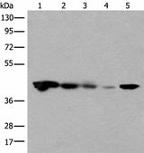 Anti-Human CECR5 Antibody - ABMIUM