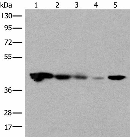 Anti-Human CECR5 Antibody - ABMIUM