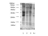 Western Blot analysis of Succinylated Lysine in various cell lines at dilution of 1:1000. Lane 1 HEK-293, Lane 2 MCF7, Lane 3 HepG2, Lane 4 Hela cell lysates.