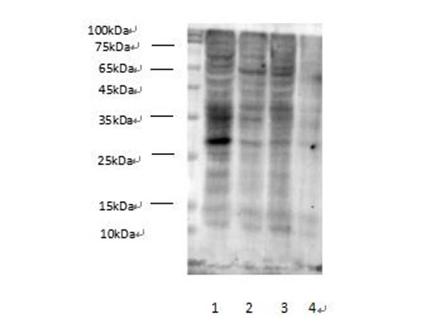 Western Blot analysis of Succinylated Lysine in various cell lines at dilution of 1:1000. Lane 1 HEK-293, Lane 2 MCF7, Lane 3 HepG2, Lane 4 Hela cell lysates.