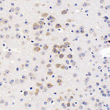 Immunohistochemistry analysis of paraffin-embedded mouse brain using GRIN2B Polyclonal Antibody at dilution of 1:200.