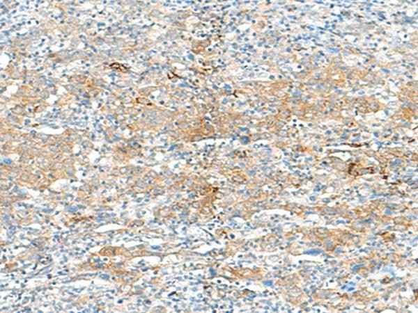 Anti-Human HLA-DRB3 Antibody