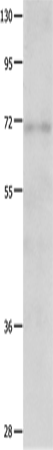 Anti-Human/Mouse/Rat IGF2BP1 Antibody - ABMIUM