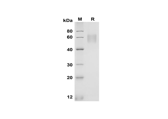 SDS-PAGE analysis of Rat Fcγ RIIB/CD32b proteins, 2 μg/lane of Recombinant Rat Fcγ RIIB/CD32b proteins was resolved with SDS-PAGE under reducing conditions, showing bands at 55-65 kDa.