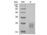 Recombinant Human ALK4/ACVR1B Protein (His Tag) - ABMIUM