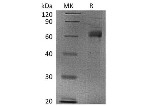 Recombinant Human Noggin/NOG Protein (aa 28-232, Fc Tag) - ABMIUM