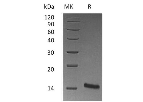 Recombinant Mouse Trefoil Factor 1/TFF1 Protein (His Tag) - ABMIUM