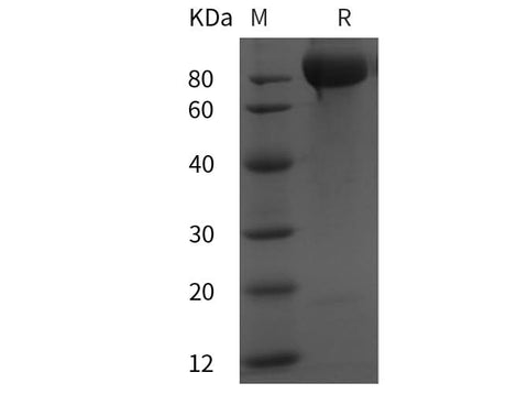 SDS-PAGE analysis of Rat Vcam1 proteins, 2 μg/lane of Recombinant Rat Vcam1 proteins was resolved with SDS-PAGE under reducing conditions, showing bands at 85 kDa.