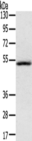 Anti-Human IL17RB Antibody - ABMIUM