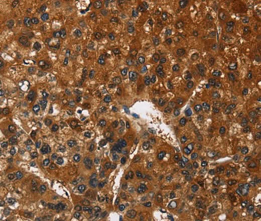 Anti-Human CATSPER4 Antibody - ABMIUM