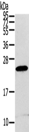 Anti-Human/Mouse RGS1 Antibody - ABMIUM