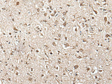 Immunohistochemistry of paraffin-embedded Human brain tissue using ZFP36 Polyclonal Antibody at dilution of 1:55(×200)