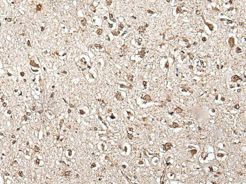 Immunohistochemistry of paraffin-embedded Human brain tissue using ZFP36 Polyclonal Antibody at dilution of 1:55(×200)