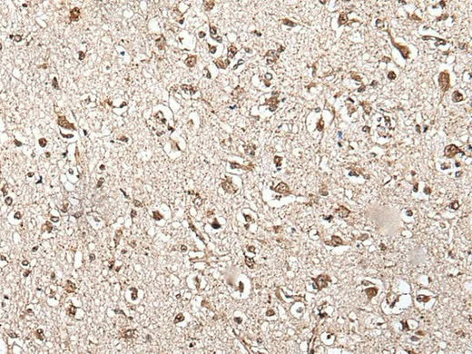Immunohistochemistry of paraffin-embedded Human brain tissue using ZFP36 Polyclonal Antibody at dilution of 1:55(×200)