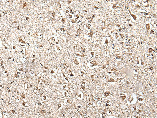 Immunohistochemistry of paraffin-embedded Human brain tissue using ZFP36 Polyclonal Antibody at dilution of 1:55(×200)