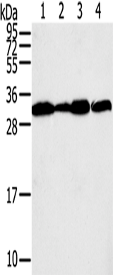 Anti-Human STX10 Antibody - ABMIUM