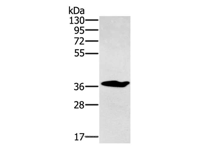 Anti-Human/Mouse/Rat NOV Antibody - ABMIUM