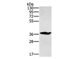 Anti-Human/Mouse/Rat NOV Antibody - ABMIUM